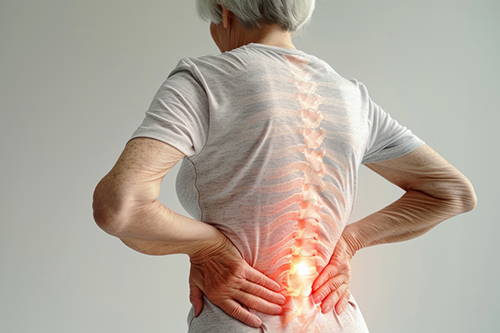 Osteoporosis Prevention: Important for all….Critical for Seniors - Grayson, GA